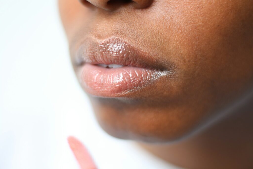 lip fillers amsterdam lip fillers amsterdam